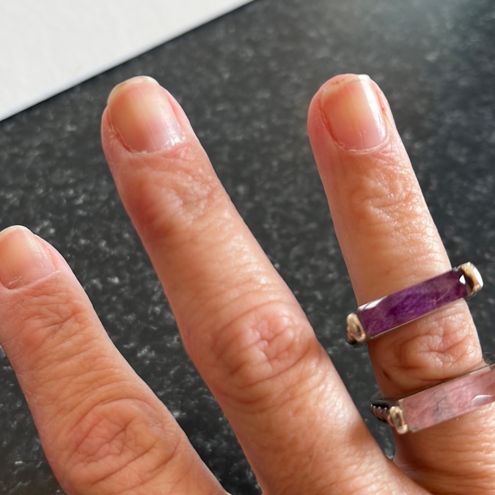 Lagos ring